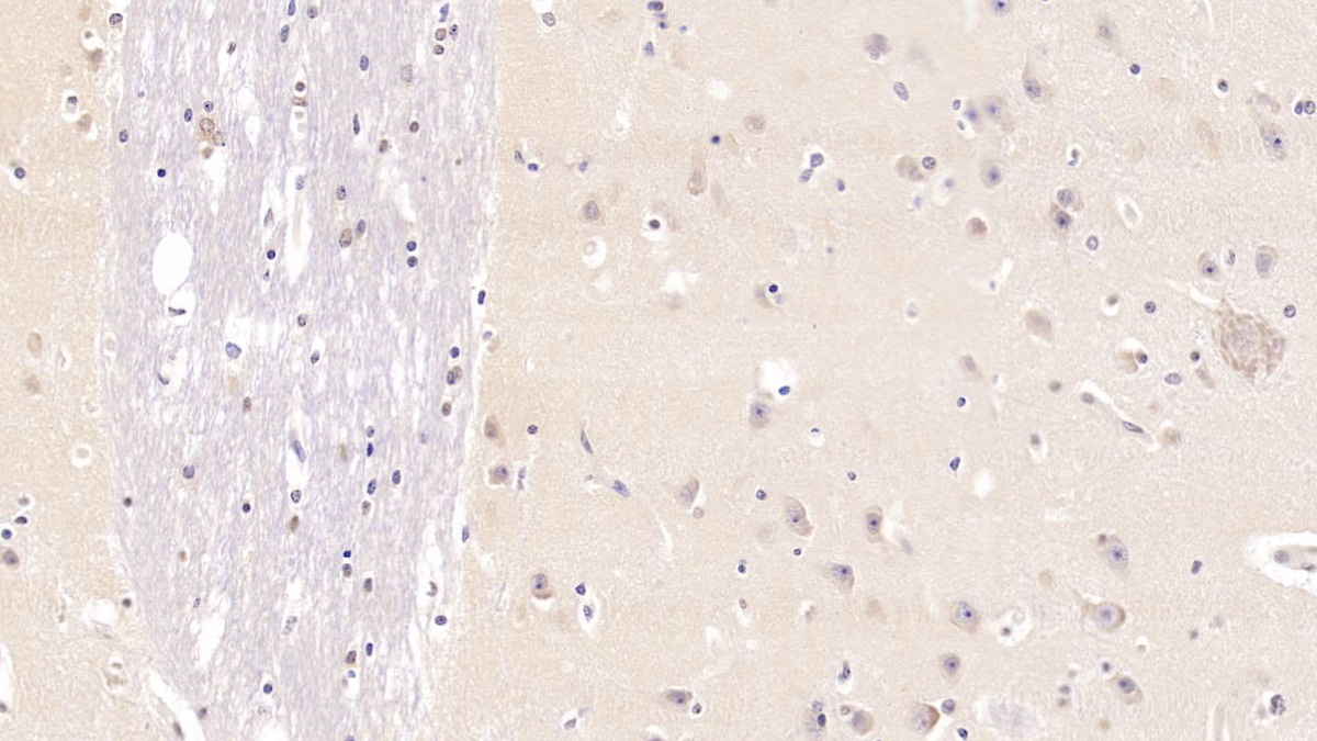 Monoclonal Antibody to Ubiquitin (Ub)