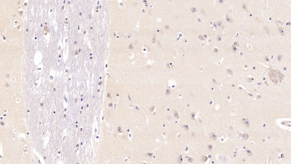 Monoclonal Antibody to Ubiquitin (Ub)