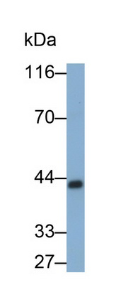 Monoclonal Antibody to Pepsinogen C (PGC)
