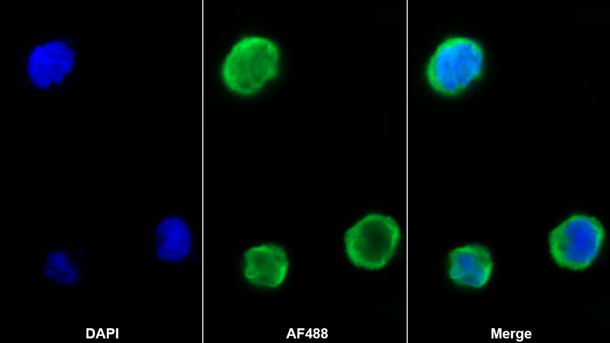 Monoclonal Antibody to Platelet Factor 4 (PF4)