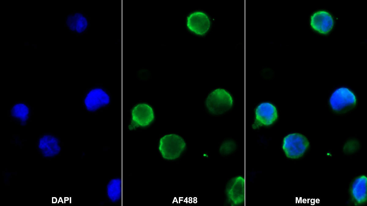 Monoclonal Antibody to Platelet Factor 4 (PF4)