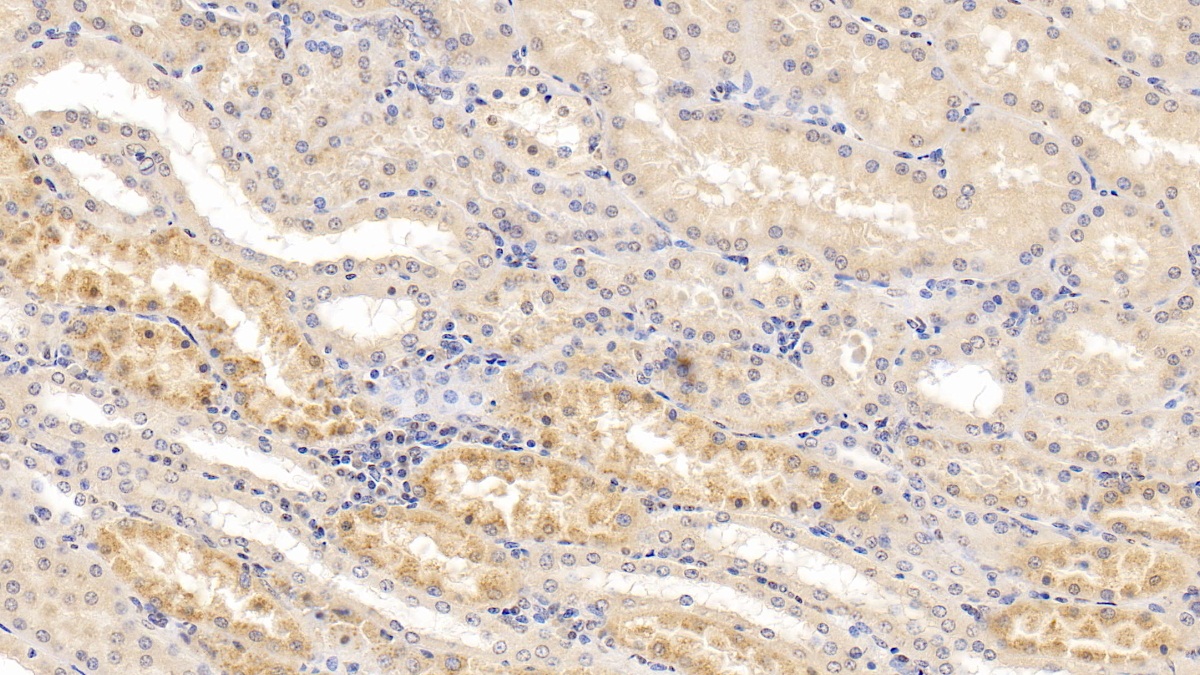 Monoclonal Antibody to Galactosidase Alpha (GLa)