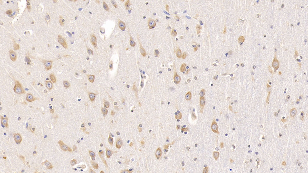 Monoclonal Antibody to Galactosidase Alpha (GLa)