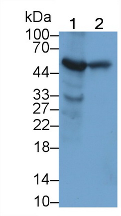 Monoclonal Antibody to Alanine Aminotransferase (ALT)