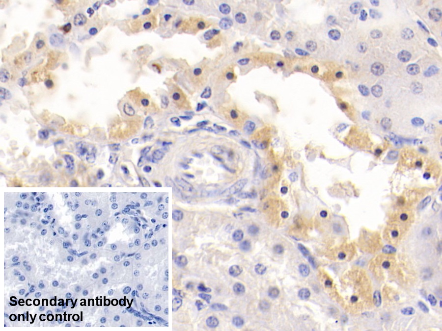 Monoclonal Antibody to Alanine Aminotransferase (ALT)