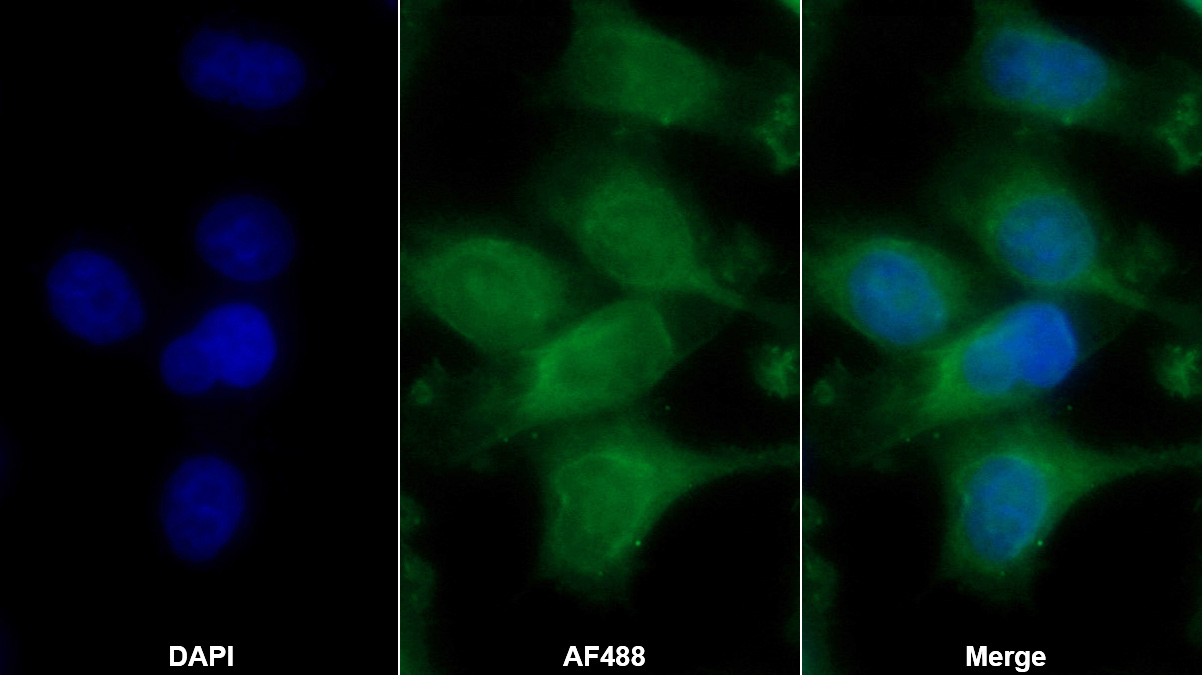 Monoclonal Antibody to Interferon Beta (IFNb)