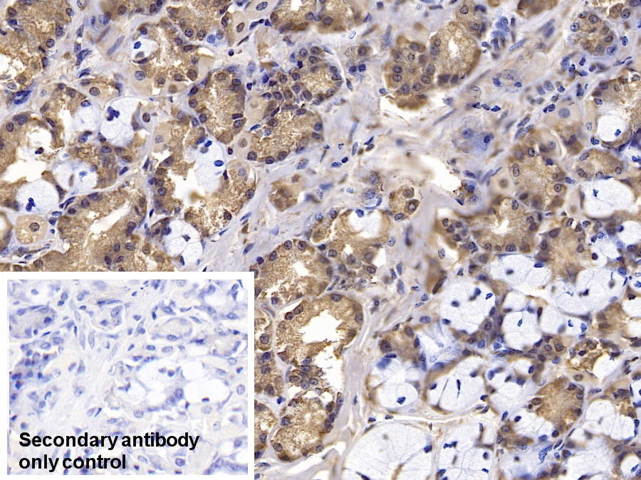 Monoclonal Antibody to Interferon Beta (IFNb)