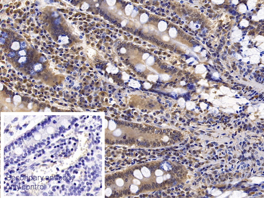 Monoclonal Antibody to Interferon Beta (IFNb)