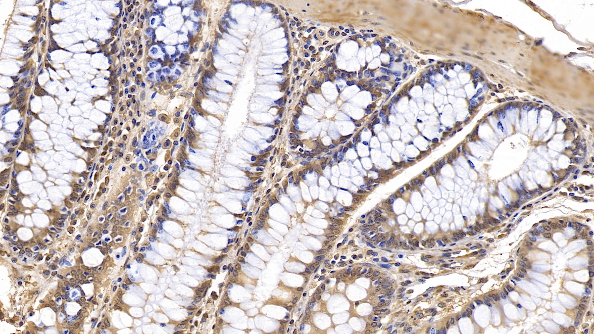 Monoclonal Antibody to Interleukin 1 Receptor Antagonist (IL1RA)