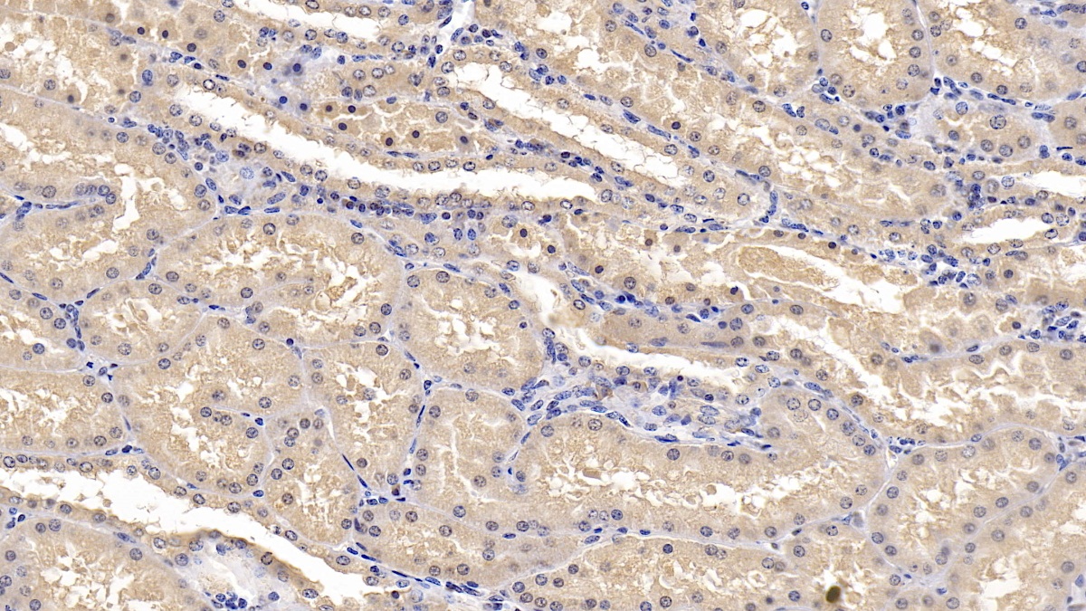 Monoclonal Antibody to Interleukin 1 Receptor Antagonist (IL1RA)