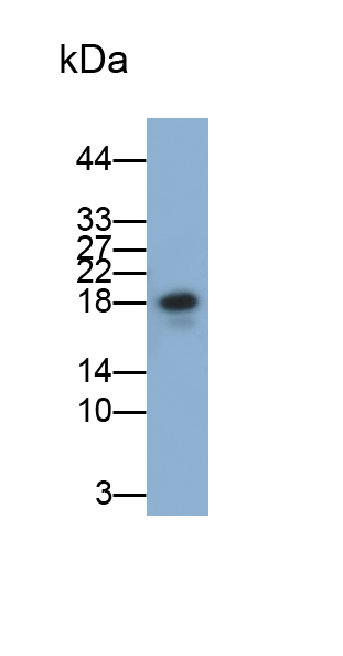 Monoclonal Antibody to Interleukin 1 Receptor Antagonist (IL1RA)