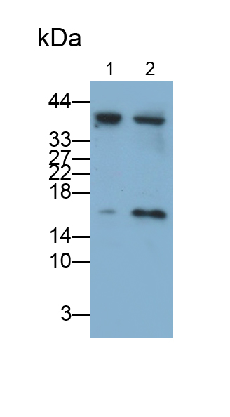 Monoclonal Antibody to Interleukin 1 Receptor Antagonist (IL1RA)