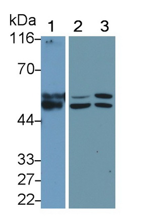 Monoclonal Antibody to Matrix Metalloproteinase 11 (MMP11)