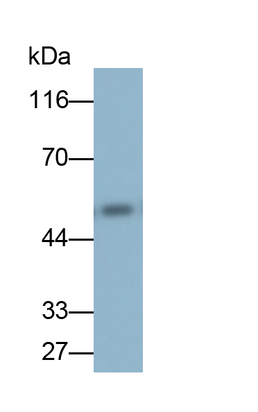 Monoclonal Antibody to Matrix Metalloproteinase 11 (MMP11)