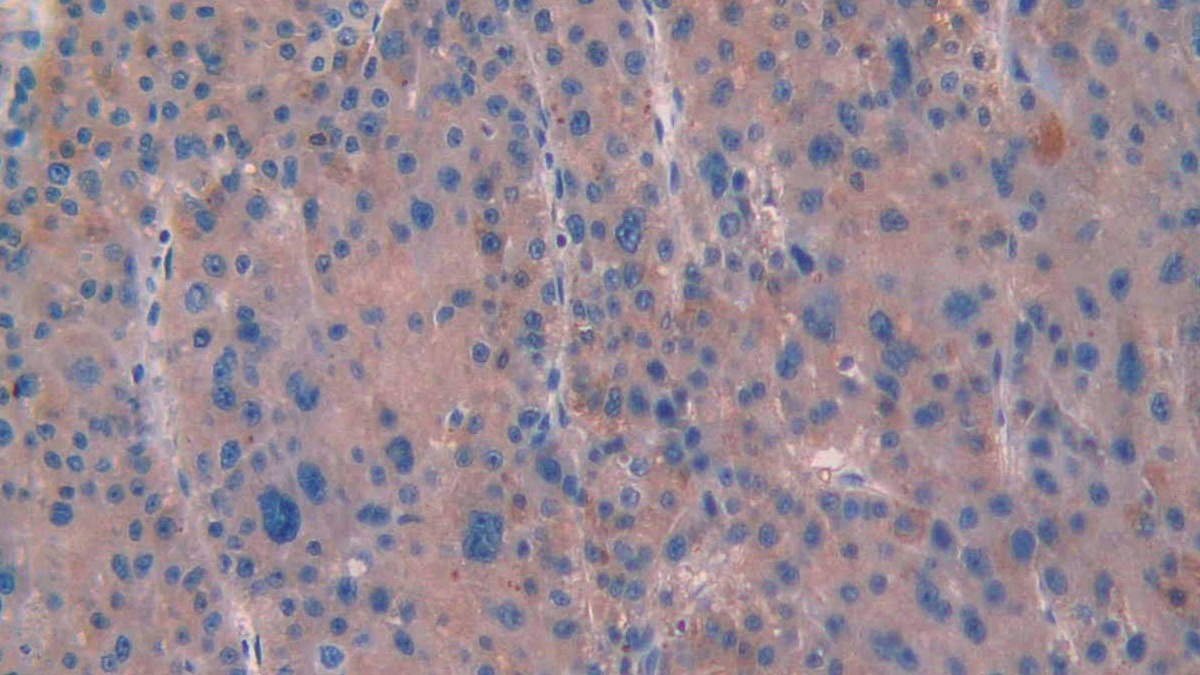 Monoclonal Antibody to Anti-Mullerian Hormone (AMH)
