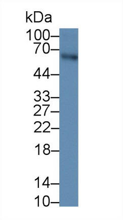 Monoclonal Antibody to Anti-Mullerian Hormone (AMH)