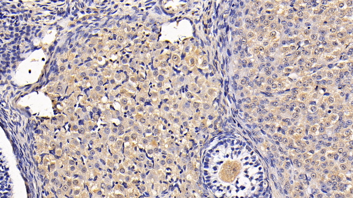 Monoclonal Antibody to Anti-Mullerian Hormone (AMH)