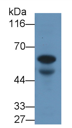 Monoclonal Antibody to Anti-Mullerian Hormone (AMH)