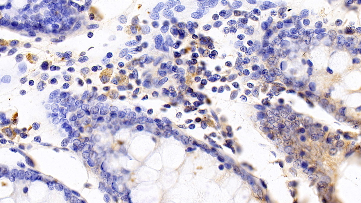 Monoclonal Antibody to Interleukin 2 Receptor Beta (IL2Rb)