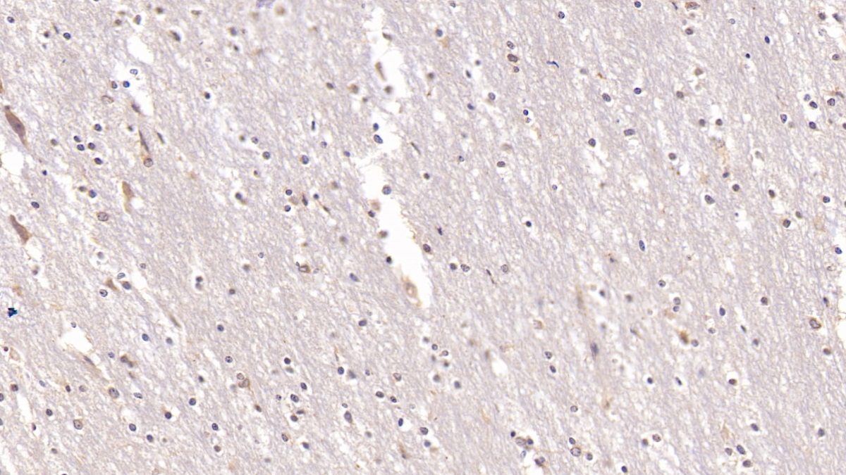 Monoclonal Antibody to Annexin V (ANXA5)