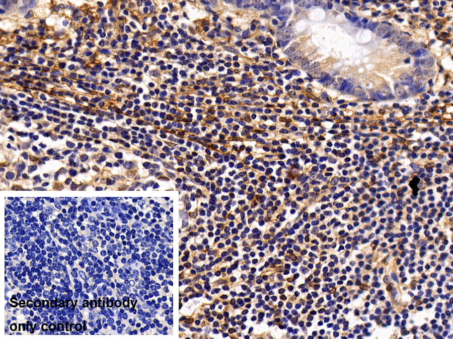 Monoclonal Antibody to Annexin V (ANXA5)
