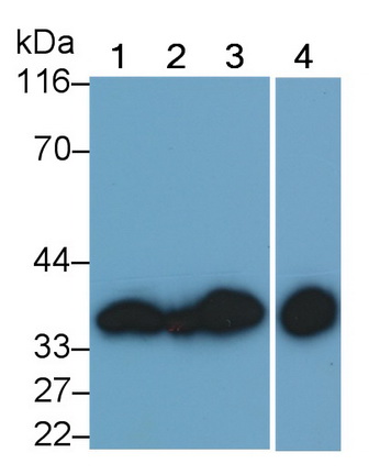 Monoclonal Antibody to Annexin V (ANXA5)