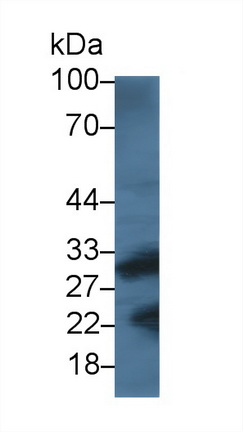 Monoclonal Antibody to Cathepsin K (CTSK)