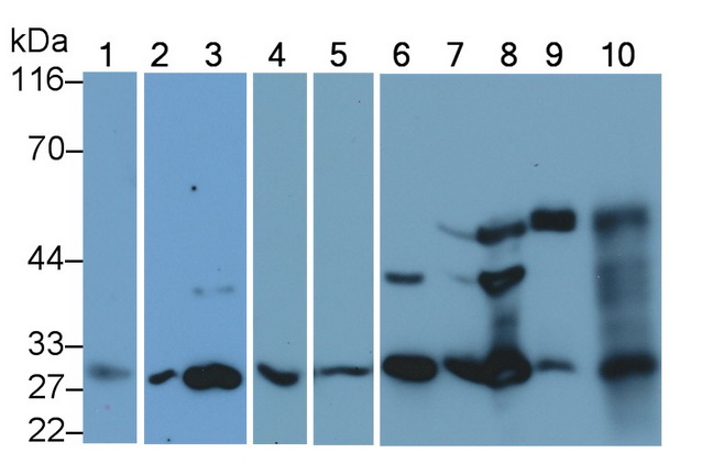 Monoclonal Antibody to Cathepsin K (CTSK)