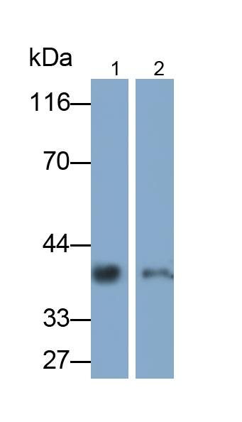 Monoclonal Antibody to Cathepsin K (CTSK)