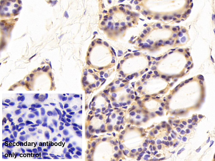 Monoclonal Antibody to Cathepsin K (CTSK)