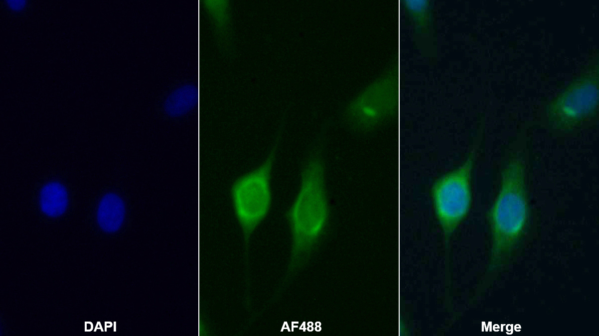 Monoclonal Antibody to Cathepsin K (CTSK)