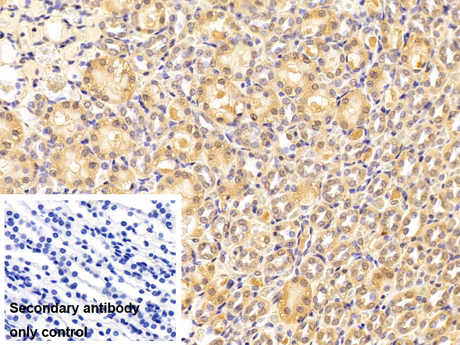 Monoclonal Antibody to Transportin 1 (TNPO1)