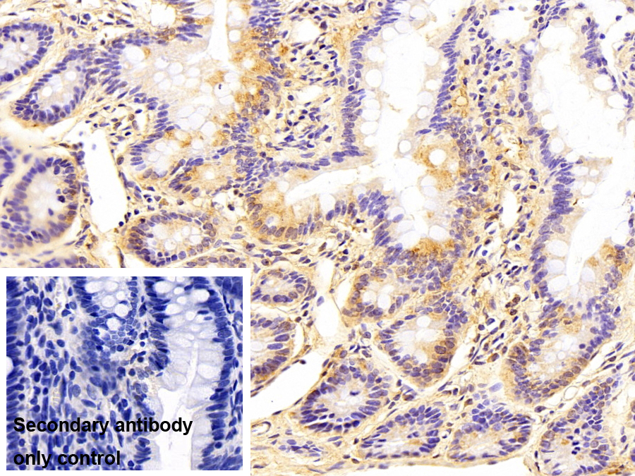 Monoclonal Antibody to Transportin 1 (TNPO1)
