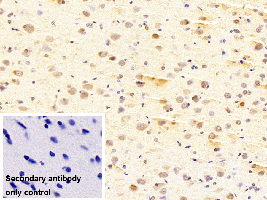 Monoclonal Antibody to Transportin 1 (TNPO1)