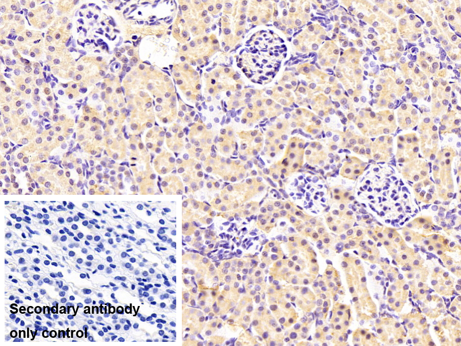 Monoclonal Antibody to Transportin 1 (TNPO1)