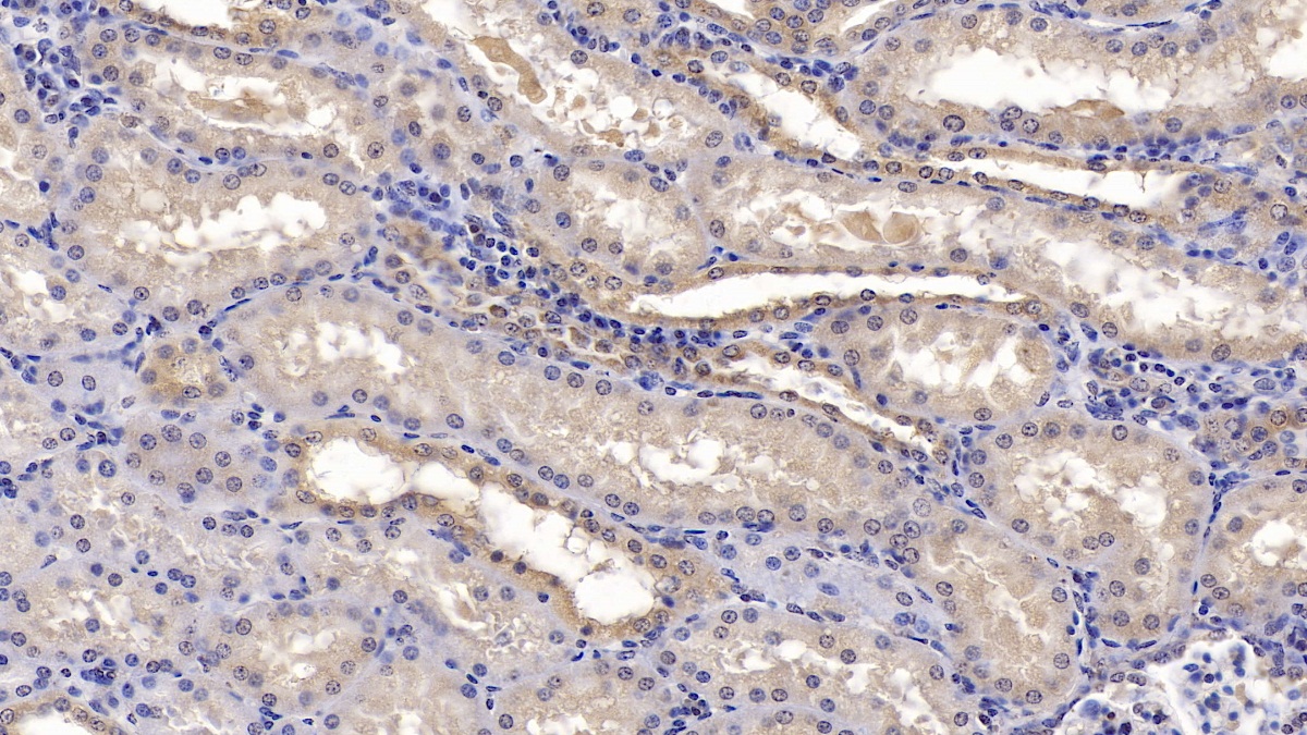 Monoclonal Antibody to Calnexin (CNX)