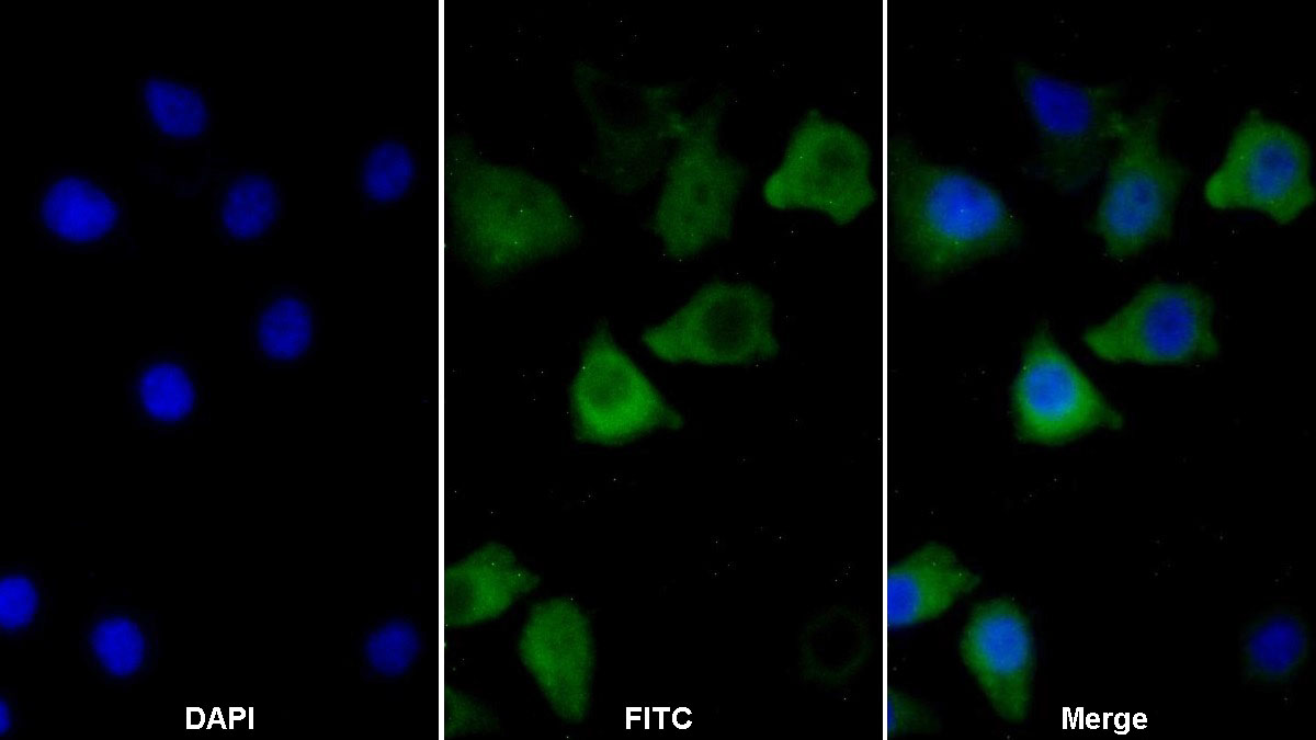 Monoclonal Antibody to Calnexin (CNX)