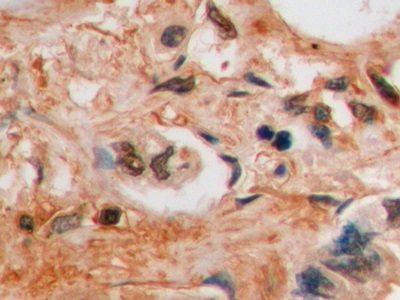 Monoclonal Antibody to Galectin 3 (GAL3)