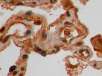 Monoclonal Antibody to Galectin 3 (GAL3)