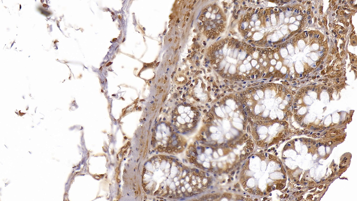 Monoclonal Antibody to Galectin 3 (GAL3)