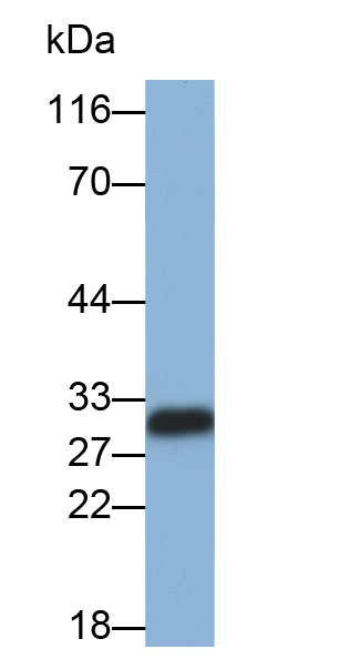 Monoclonal Antibody to Galectin 3 (GAL3)