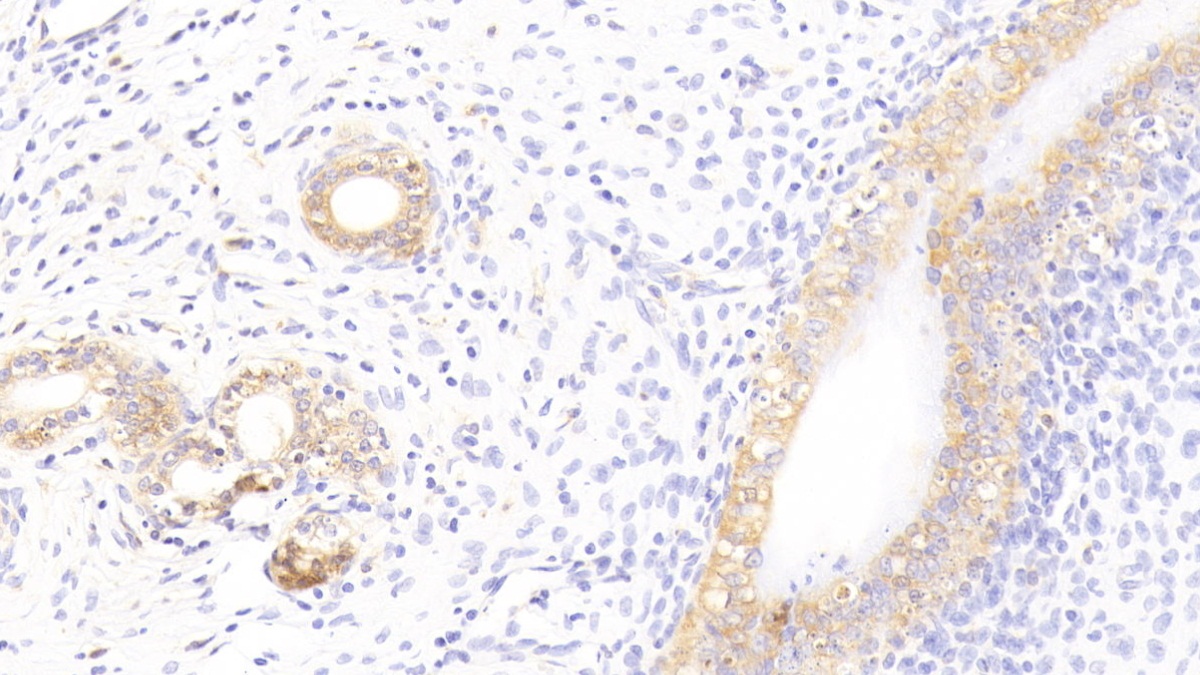 Monoclonal Antibody to Galectin 3 (GAL3)