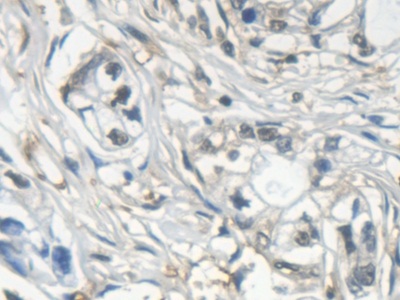 Monoclonal Antibody to Galectin 7 (GAL7)