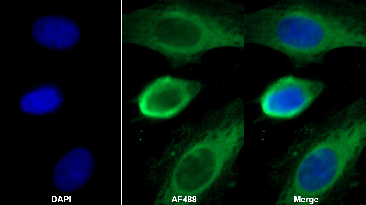 Monoclonal Antibody to Galectin 8 (GAL8)