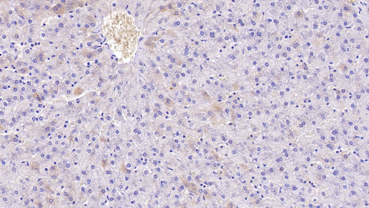 Monoclonal Antibody to Apolipoprotein H (APOH)