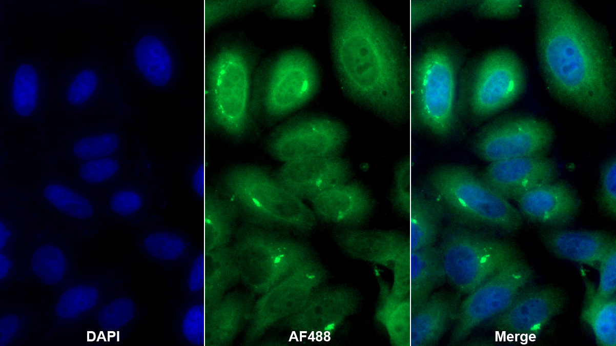 Monoclonal Antibody to Heterogeneous Nuclear Ribonucleoprotein A2/B1 (HNRPA2B1)