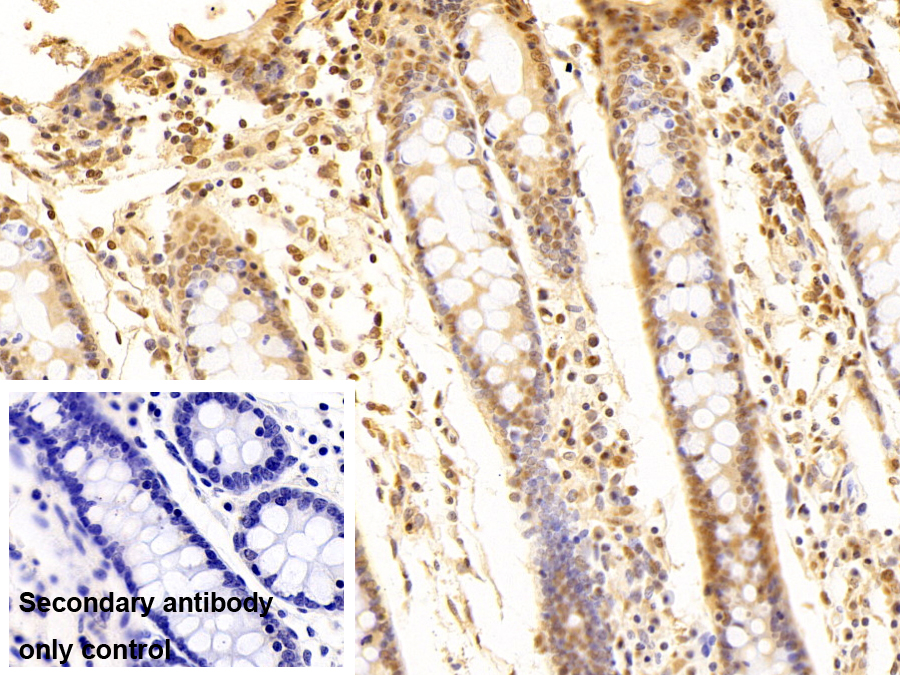 Monoclonal Antibody to Heterogeneous Nuclear Ribonucleoprotein A2/B1 (HNRPA2B1)
