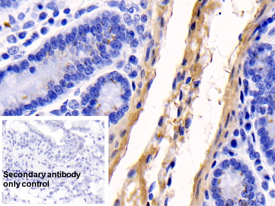 Monoclonal Antibody to Collagen Type I Alpha 1 (COL1a1)