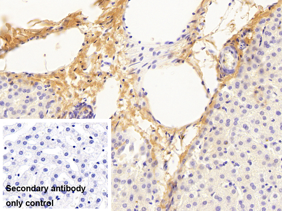 Monoclonal Antibody to Collagen Type I Alpha 1 (COL1a1)