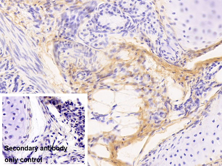 Monoclonal Antibody to Collagen Type I Alpha 1 (COL1a1)